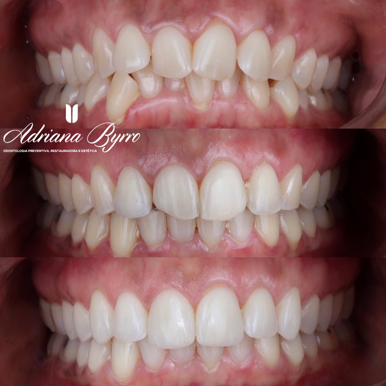 Antes-e-depois-02.jpg