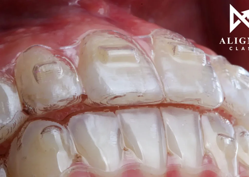 Close Invisalign