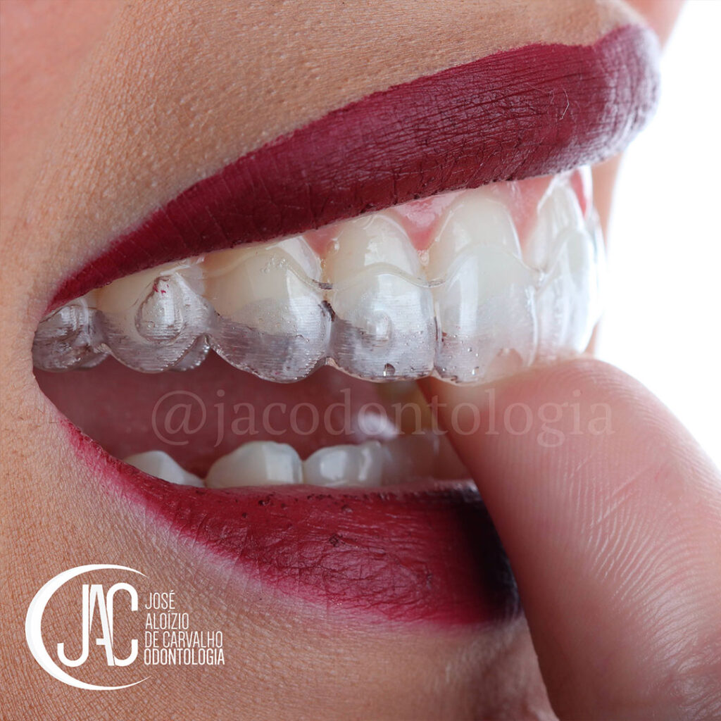 Invisalign em Belo Horizonte - Funcionarios